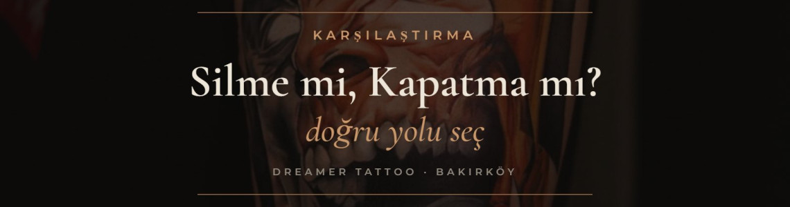 Dövme Silme mi, Kapatma mı? Hangisi Size Uygun?