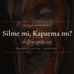 Dövme Silme mi, Kapatma mı? Hangisi Size Uygun?