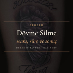 Dövme Silme Rehberi: Lazerle Dövme Silme Nasıl Yapılır, Kaç Seans Sürer?